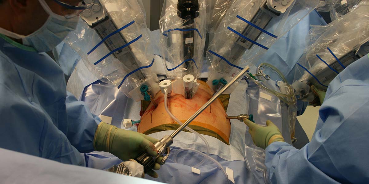 robotic prostate surgery)