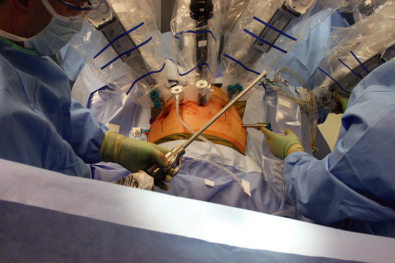 selv sandwich Forløber Robot-Assisted Prostate Surgery | Servo Magazine